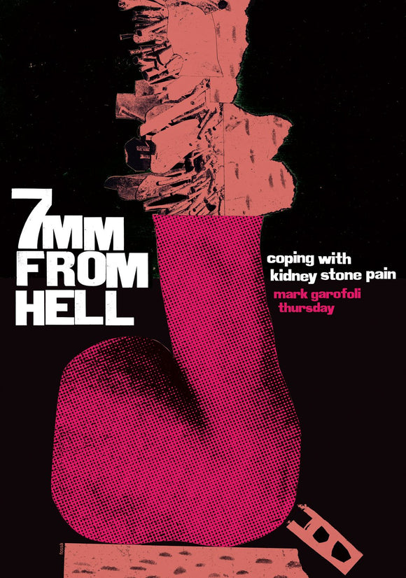 7mm from Hell: Coping with Kidney Stone Pain