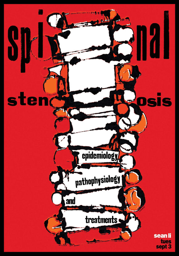 Spinal Stenosis: Epidemiology, Pathophysiology, and Treatment