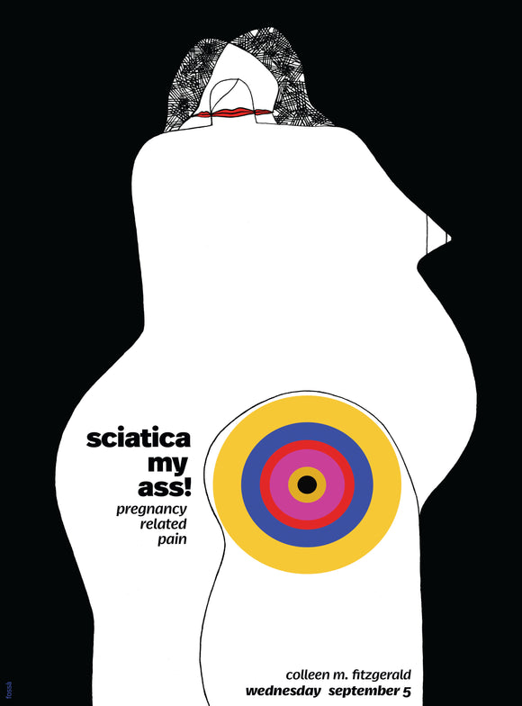 Pregnancy Related Pain: Sciatica My Ass!